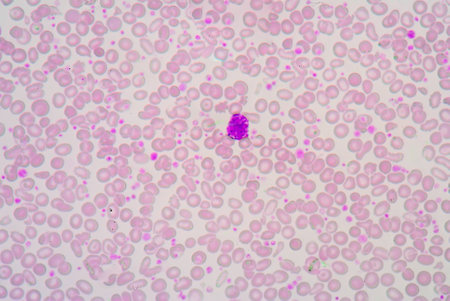 Blood smear