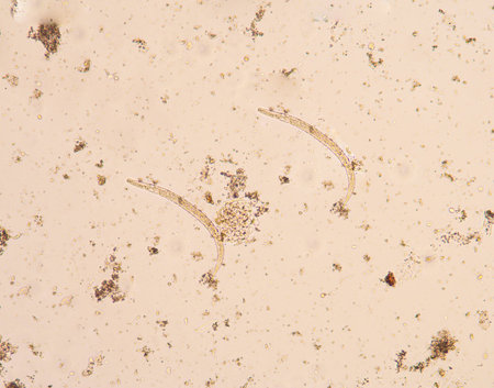 Strongyloides stercoralis is a human parasitic roundworm causing the disease strongyloidiasis.