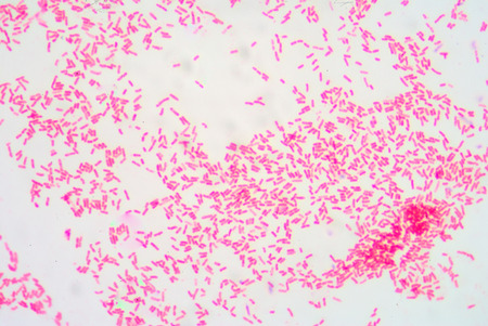 Gram staining ,gram negative bacilli.の写真素材
