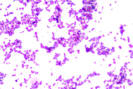 Gram staining,gram positive cocci.