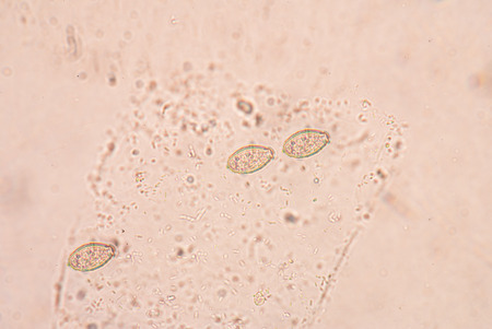Opisthorchis viverrini, common name Southeast Asian liver fluke, is a trematode parasite.