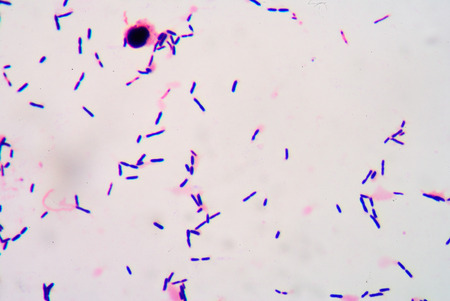 gram stian was show gram positive bacilli.の写真素材