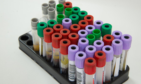 Blood tube specimen for testing in laboratory.