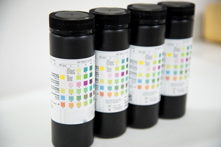 Urine strip test.の写真素材