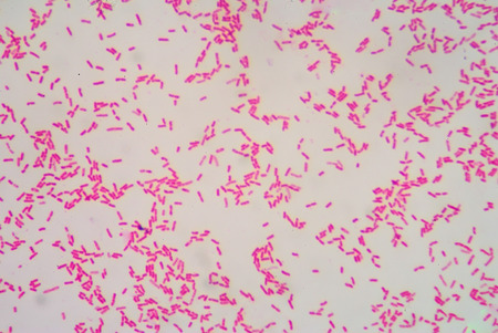 Gram staining, also called Gram's method, is a method of differentiating bacterial species into two large groups (gram-positive and gram-negative). The name comes from the Danish bacteriologist Hans Christian Gram who developed the technique.の写真素材