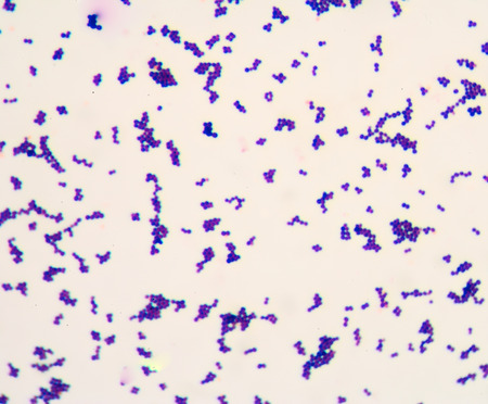Gram staining, also called Gram's method, is a method of differentiating bacterial species into two...