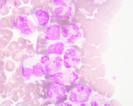 white blood cellsの写真素材