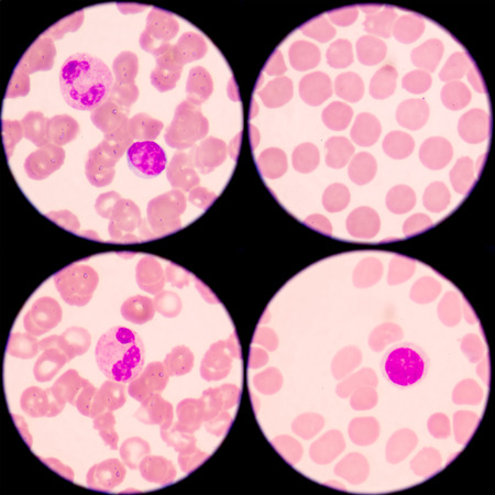 white blood cellsの写真素材