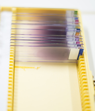 blood smear.の写真素材