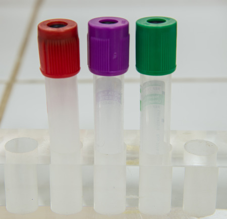 tubes prepared in lab centrifuge machine.の写真素材