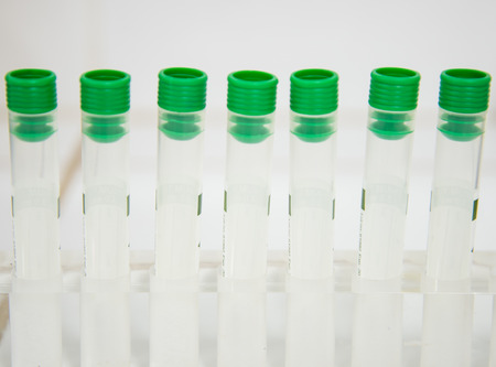 Blood tube for testing in laboratory.
