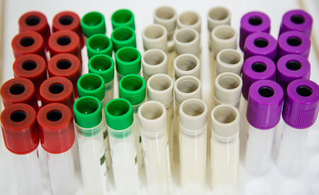 Blood tube for testing in laboratory.
