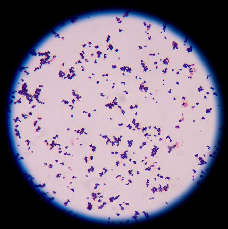 Gram positive cocci,gram stain.
