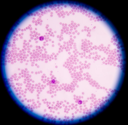 White blood cells of a human, photomicrograph panorama as seen under the microscopeの写真素材
