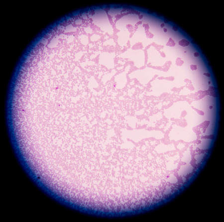 White blood cells of a human, photomicrograph panorama as seen under the microscope
