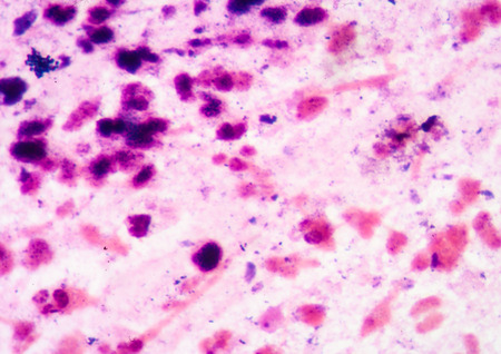 white blood cell in sputum gram stain.