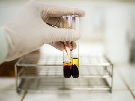 Blood type test tubes in real labの写真素材