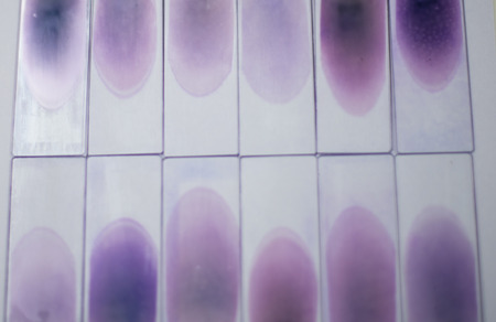 Blood smearの写真素材