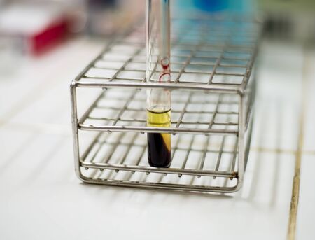 Blood type test tubes in real lab