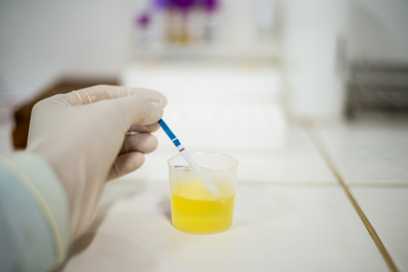urine pregnancy analysisの写真素材