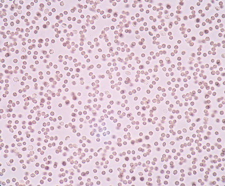 red blood cells.