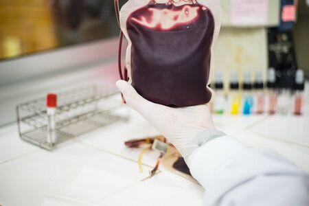 donate blood concept . Hand Holding a Bag of Bloodの写真素材