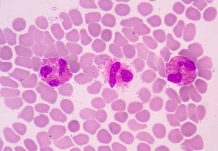 White blood cells of a human, Eosinophil photomicrograph panorama as seen under the microscopeの写真素材