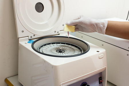 electronic Hematocrit centrifuge in medical clinicの写真素材