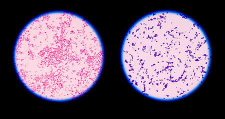 Gram staining, also called Gram's method, is a method of differentiating bacterial species into two large groups (Gram-positive and Gram-negative).の写真素材