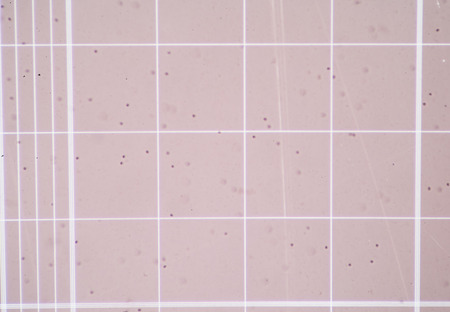 scale Counting chamber find with microscope in laboratory.