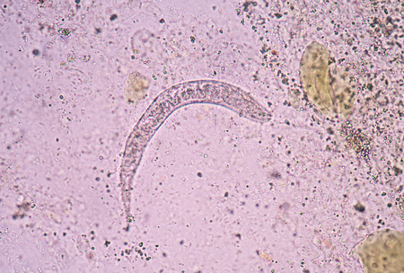 Strongyloides stercoralis is a human parasitic roundworm causing the disease strongyloidiasis.