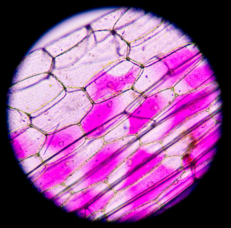 Pink plant cells under microscope.400x