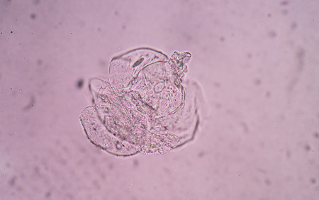 squamous cellの写真素材