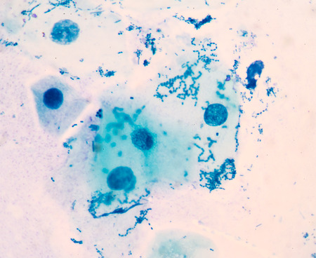 Gram staining, also called Gram's method, is a method of differentiating bacterial species into two...