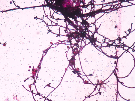 Branching budding yeast cells with pseudohyphae in urine gram stain fine with microscope.の写真素材