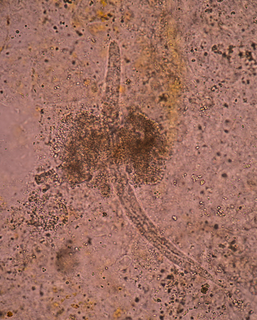 Strongeroides stercolaris : Rhabtidiform larva state in human stool under microscope 400X