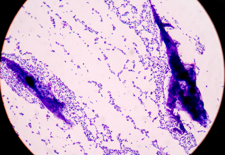 Gram staining, also called Gram's method, is a method of differentiating bacterial species into two...