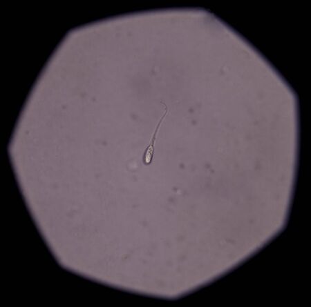 The spermatozoa of animals are produced through spermatogenesis inside the male gonads (testicles) via meiotic division.の写真素材