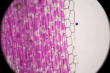 Real photo of plant cells and stoma.Pink plants cells.