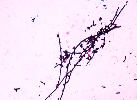 Branching budding yeast cells with pseudohyphae in urine gram stain fine with microscope.の写真素材