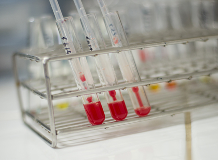 blood tubes in the laboratory