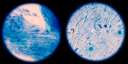 Mycobacterium tuberculosis is a pathogenic bacterial species in the family Mycobacteriaceae and the...