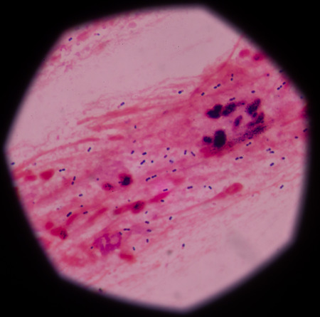 Gram staining, also called Gramâ€™s method, is a method of differentiating bacterial species...