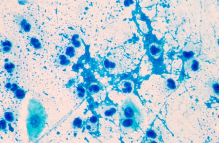 blue backgroundの写真素材