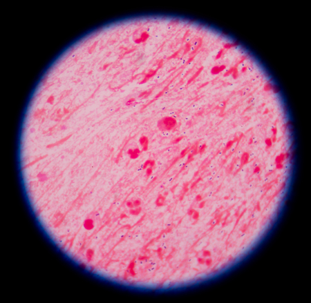 bacteria on red background.