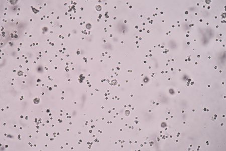cells in urine