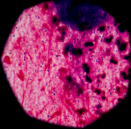 blood smear