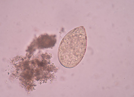 Egg parasite in stool exam.の写真素材