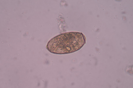 Egg parasite in stool exam.の写真素材