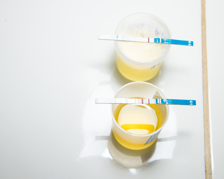 urine pregnancy test uper negative lower positive.